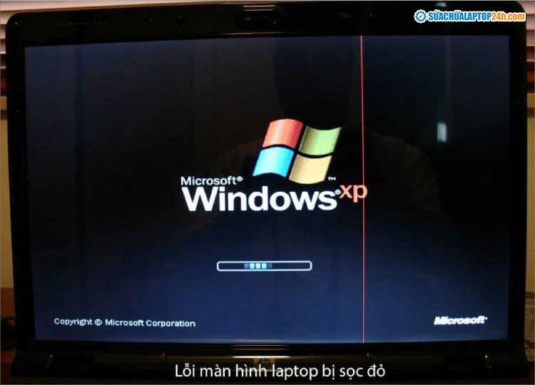 Màn hình laptop bị sọc khi vào Windows thường do xung đột phần mềm, Driver